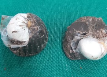 Mujer llevaba bombones rellenos con pasta base a su pareja presa en la cárcel